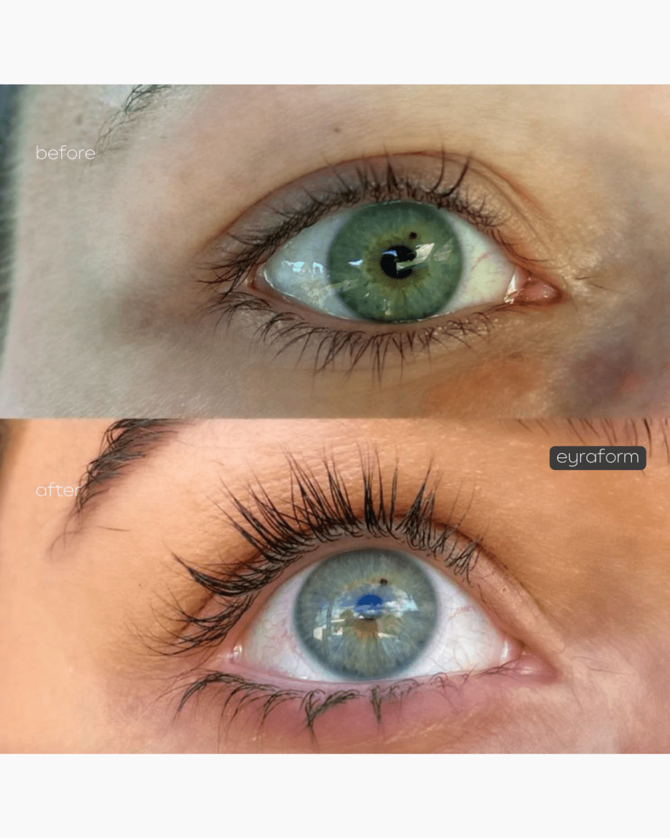 The Lash Serum — 1 year supply - EYRĀ