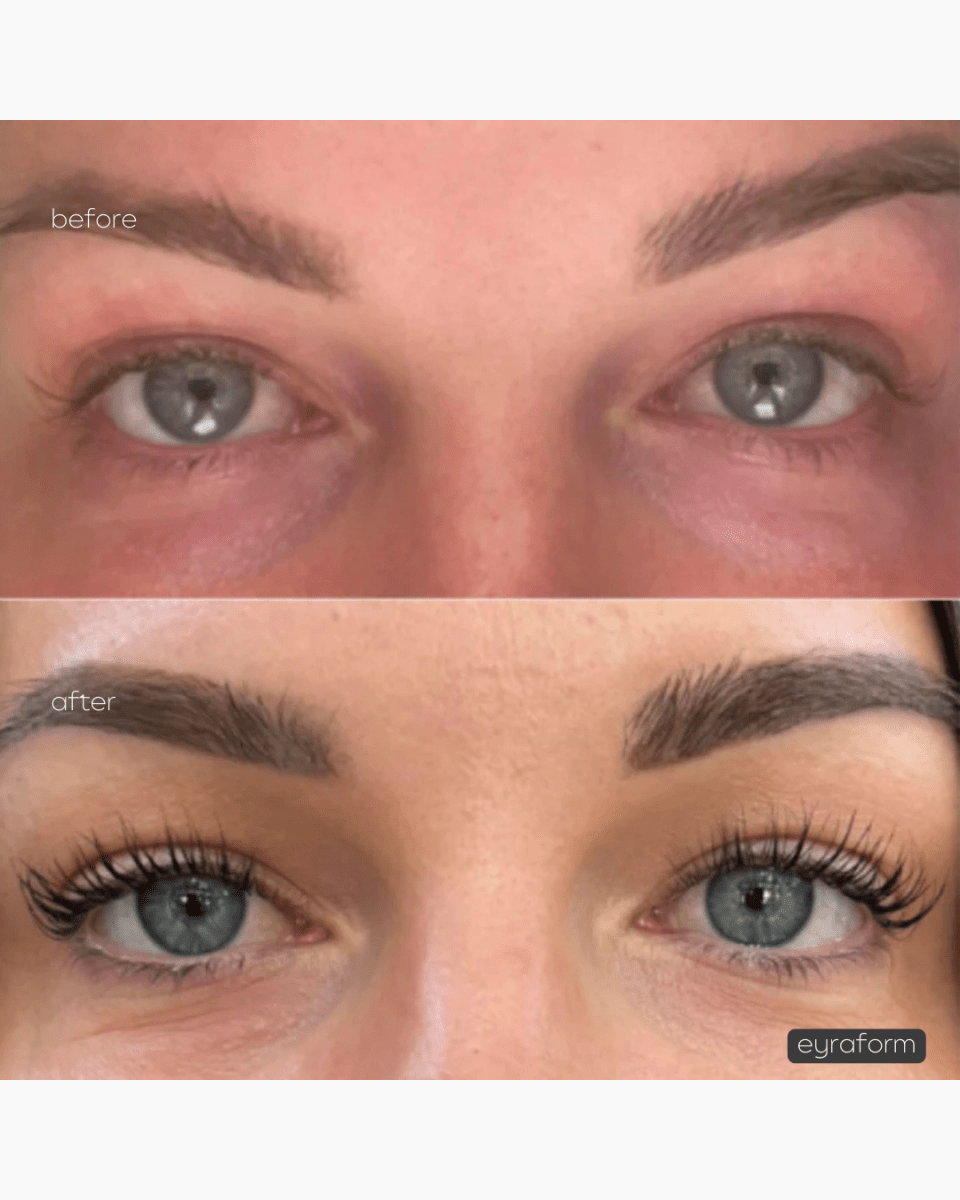 The Lash Serum — 1 year supply - EYRĀ