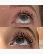 Before after EYRĀ