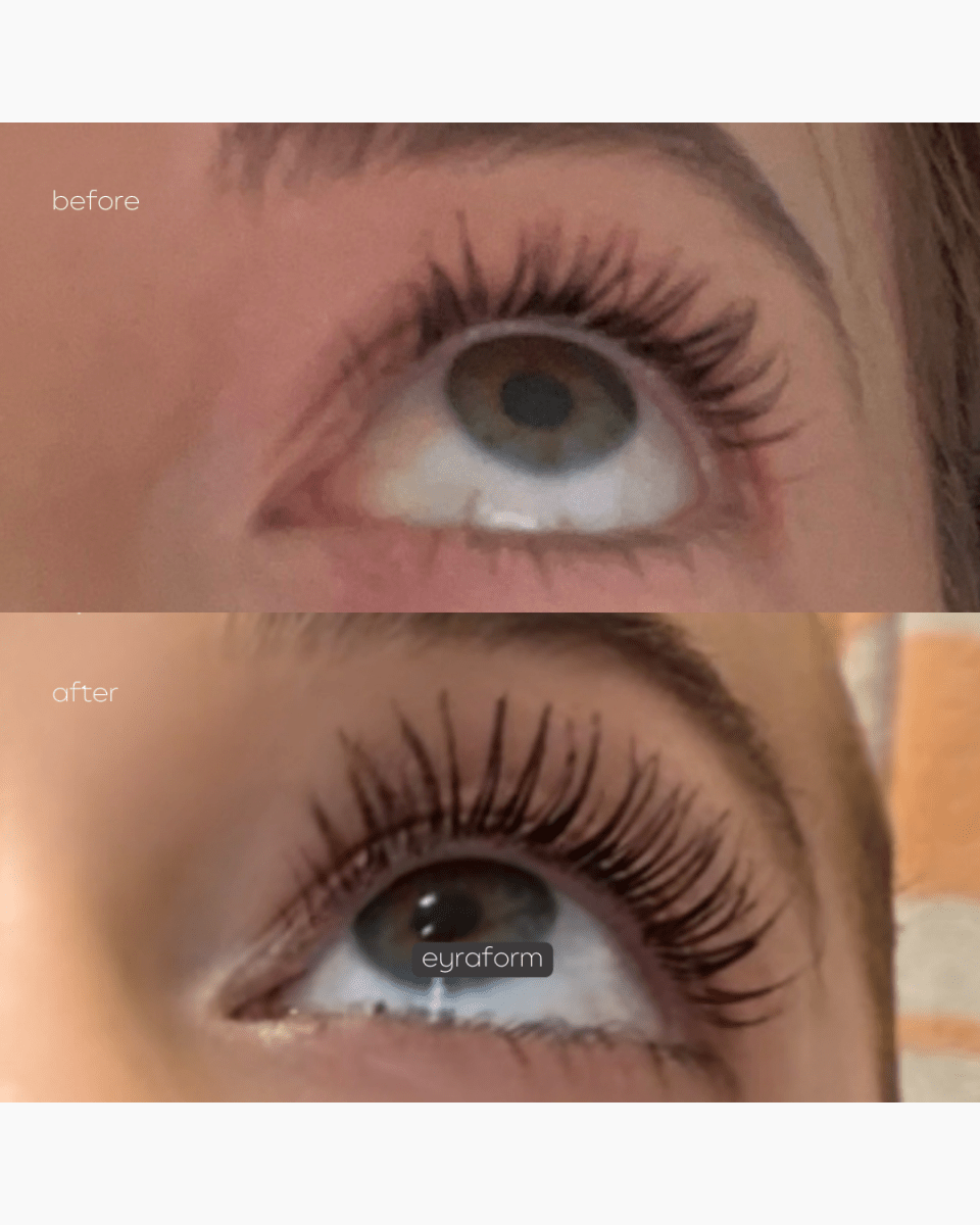 Before after EYRĀ