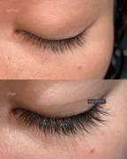 Before after EYRĀ