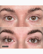 Before after EYRĀ